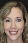 Facial Filler case #3625