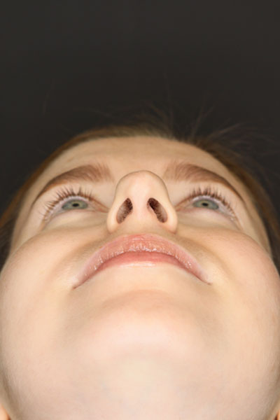 Rhinoplasty case #3946