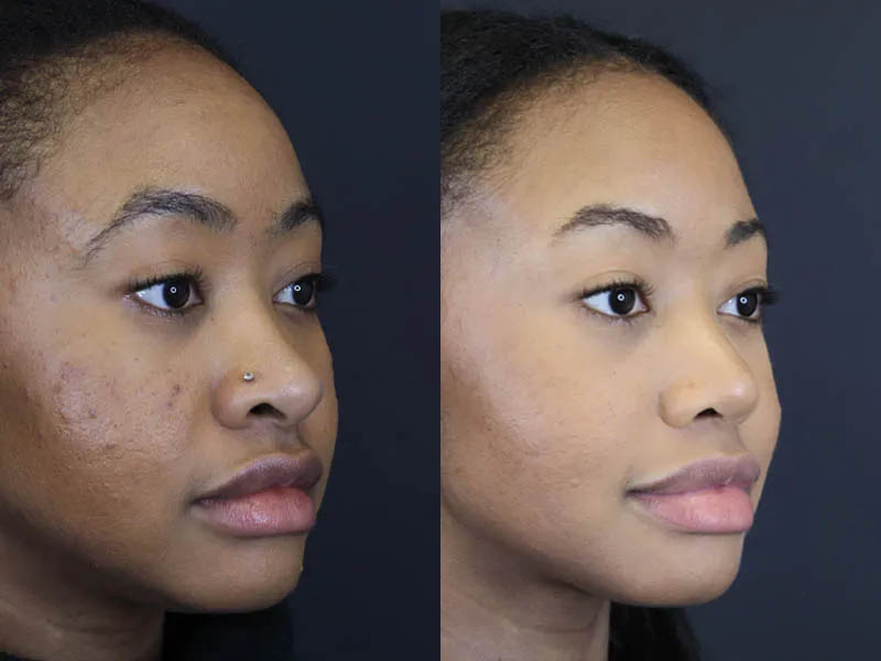 Raggio MD Skincare case #5319