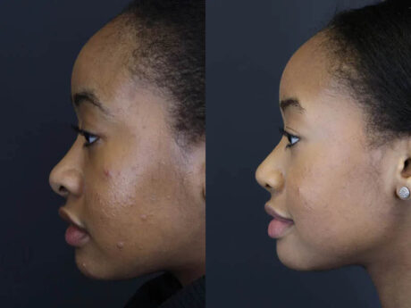 Raggio MD Skincare case #5319