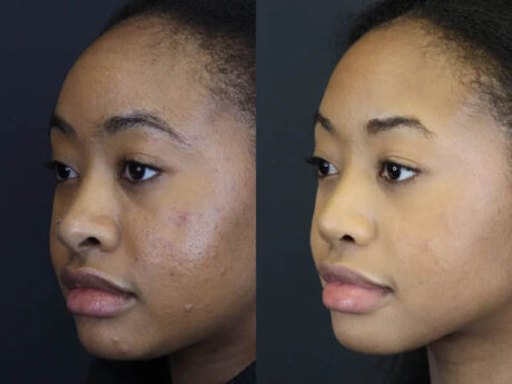 Raggio MD Skincare case #5319