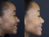 Raggio MD Skincare case #5319 slider thumbnail