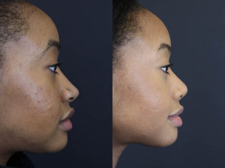 Raggio MD Skincare case #5319