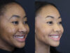 Raggio MD Skincare case #5319 slider thumbnail