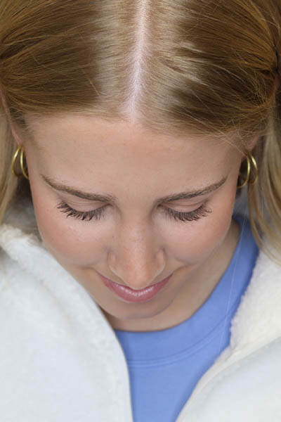 Rhinoplasty case #5794