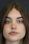 Rhinoplasty case #8366