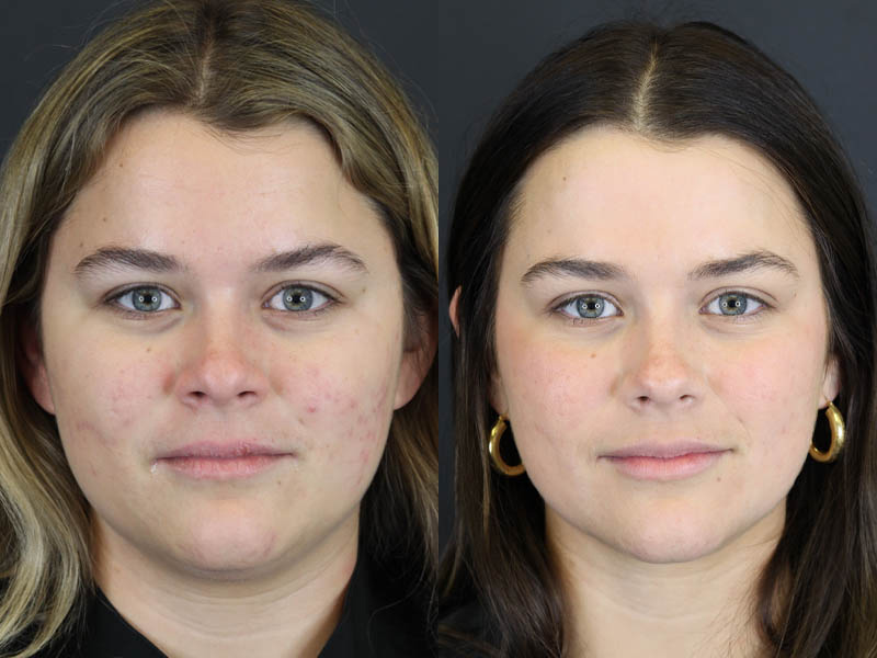 Before and After Plastic Surgery Results | Raggio MD Birmingham, Al