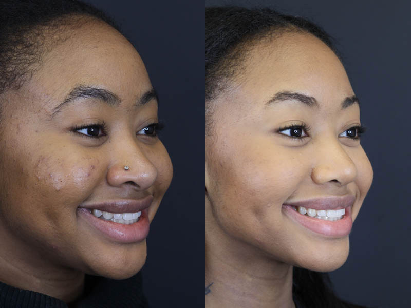 Before and After Plastic Surgery Results | Raggio MD Birmingham, Al