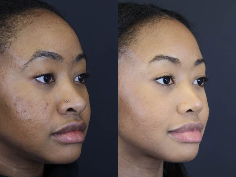 Before and After Plastic Surgery Results | Raggio MD Birmingham, Al