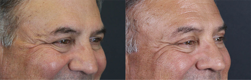 Before and After Plastic Surgery Results | Raggio MD Birmingham, Al