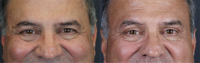 Before and After Plastic Surgery Results | Raggio MD Birmingham, Al